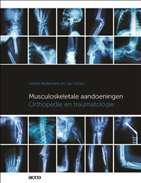 Musculoskeletale aandoeningen (Paperback)