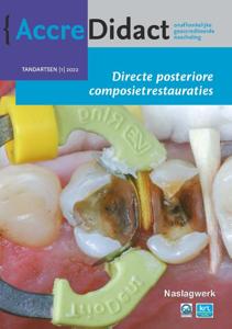 Directe posteriore composietrestauraties (Paperback)