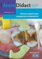 Directe posteriore composietrestauraties (Paperback)