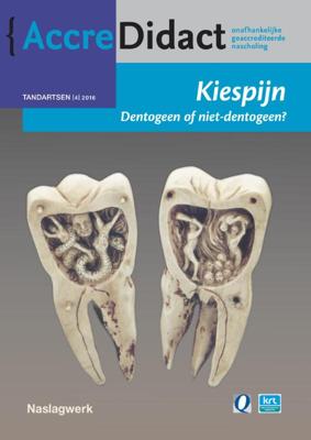 Kiespijn, dentogeen of niet-dentogeen? (Paperback)