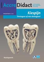 Kiespijn, dentogeen of niet-dentogeen? (Paperback)