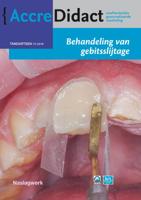 Behandeling van gebitsslijtage (Paperback)