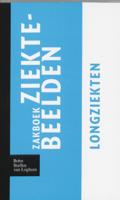 Zakboek ziektebeelden Longziekten (Paperback)