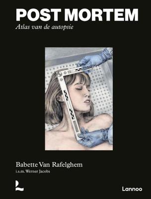 Post mortem. Atlas van de autopsie (Hardback)