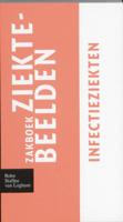 Zakboek ziektebeelden (Paperback)