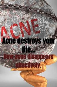 Acne destroys your life... - Jaquelien Papenhuijzen - ebook