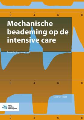 Mechanische beademing op de intensive care (Paperback)