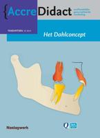 Het dahlconcept (Paperback)