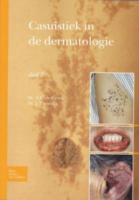 Casuïstiek in de dermatologie (Paperback)