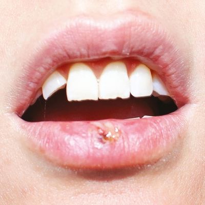 Party Time - LP (8717931338950)