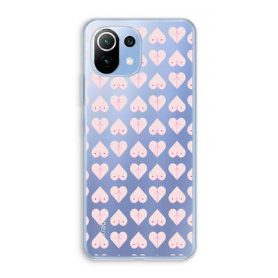 Ass 'n Titties: Xiaomi Mi 11 Lite Transparant Hoesje