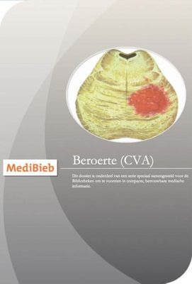 Dossier beroerte - Medica Press - ebook