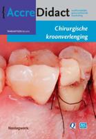 Chirurgische kroonverlenging (Paperback)