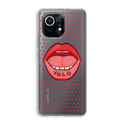 Yolo Denise: Xiaomi Mi 11 Transparant Hoesje