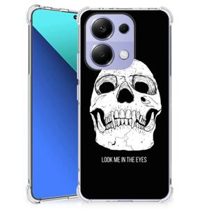 Extreme Case Xiaomi Redmi Note 13 4G Skull Eyes