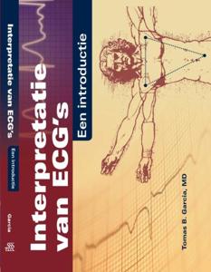 Interpretatie van ECG&apos;s (Paperback)