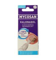 Anti kalknagel