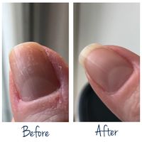 Herome Exit Damaged Nails Herstellende Nagelolie 7ml - thumbnail