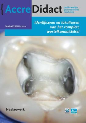 Identificeren en lokaliseren van het complete wortelkanaalstelsel (Paperback)