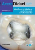 Identificeren en lokaliseren van het complete wortelkanaalstelsel (Paperback)