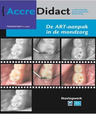 De ART-aanpak in de mondzorg (Paperback)
