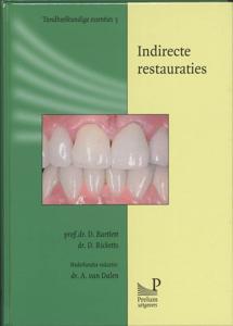 Indirecte restauraties (Paperback)