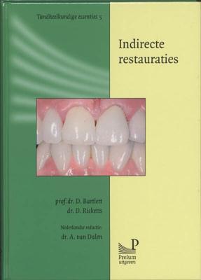 Indirecte restauraties (Paperback)