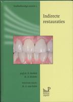 Indirecte restauraties (Paperback) Indirecte restauraties (Paperback)
