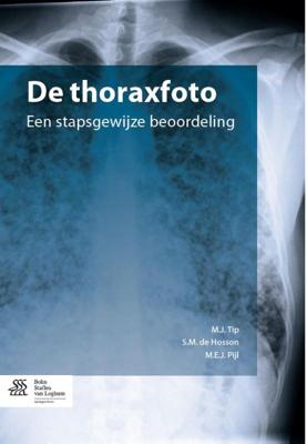 De thoraxfoto (Paperback)