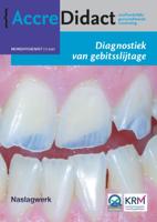 Diagnostiek van gebitsslijtage (Paperback)