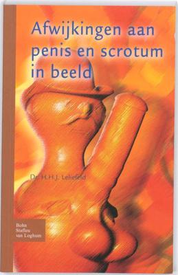 Afwijkingen aan penis en scrotum in beeld (Paperback)