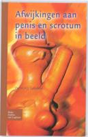 Afwijkingen aan penis en scrotum in beeld (Paperback)