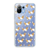 Doggy: Xiaomi Mi 11 Lite Transparant Hoesje