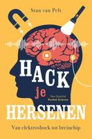 Hack je hersenen (Paperback)