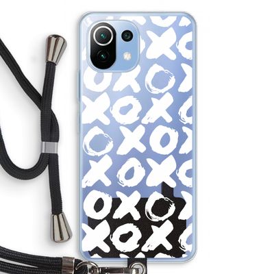 XOXO: Xiaomi Mi 11 Lite Transparant Hoesje met koord
