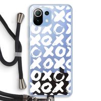 XOXO: Xiaomi Mi 11 Lite Transparant Hoesje met koord