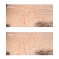 Perricone MD Essential Fx Acyl-Glutathione: Deep Crease Gezichtsserum 30 ml Vrouwen Roze - thumbnail