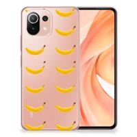 Xiaomi Mi 11 Lite | 11 Lite 5G NE | Siliconen Case | Banana