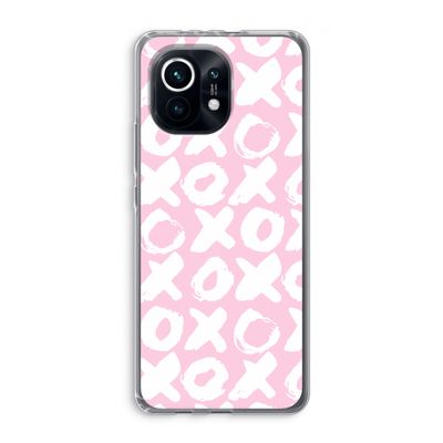 XOXO: Xiaomi Mi 11 Transparant Hoesje