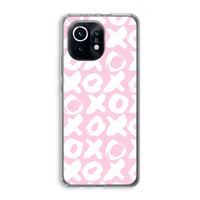 XOXO: Xiaomi Mi 11 Transparant Hoesje