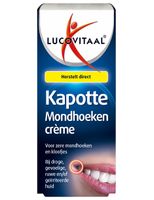 Kapotte mondhoeken creme