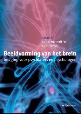 Beeldvorming van het brein (Hardback)