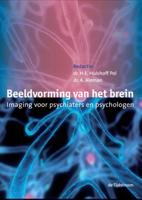 Beeldvorming van het brein (Hardback)