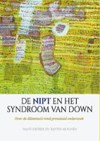 De NIPT en het syndroom van Down (Paperback)