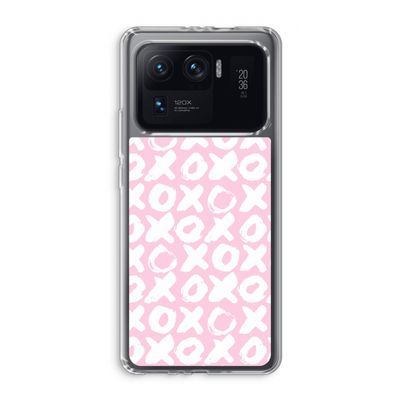 XOXO: Xiaomi Mi 11 Ultra Transparant Hoesje