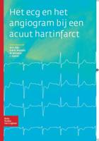 Het ECG en het angiogram bij een acuut hartinfarct (Paperback)