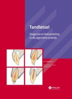 Tandletsel (Hardback)