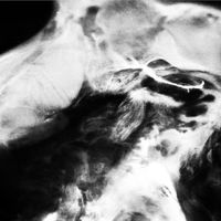 A New Life - CD (4024572543358) - thumbnail